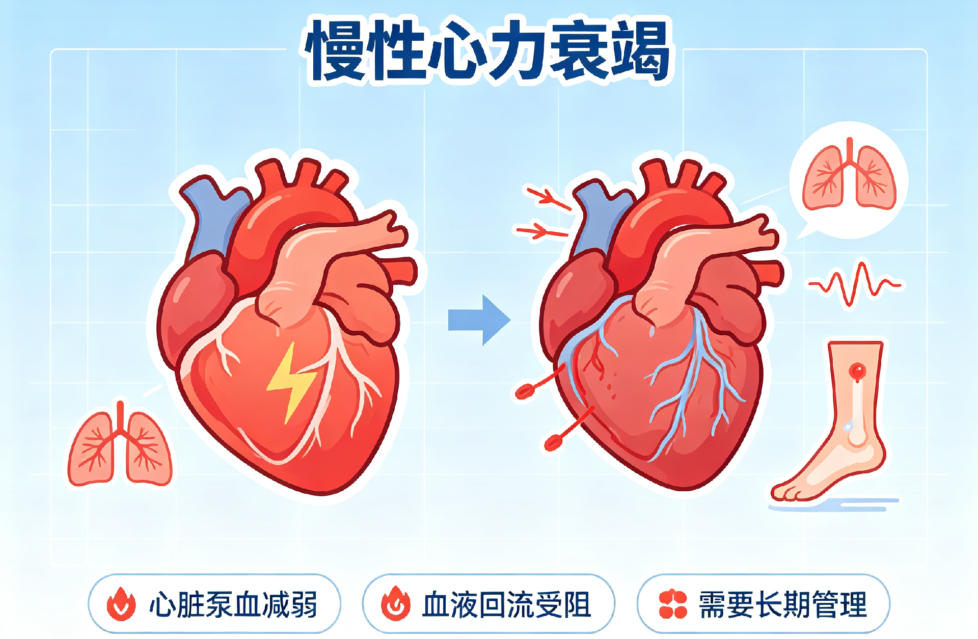 卡通风格冠心病图片生成 (4).png
