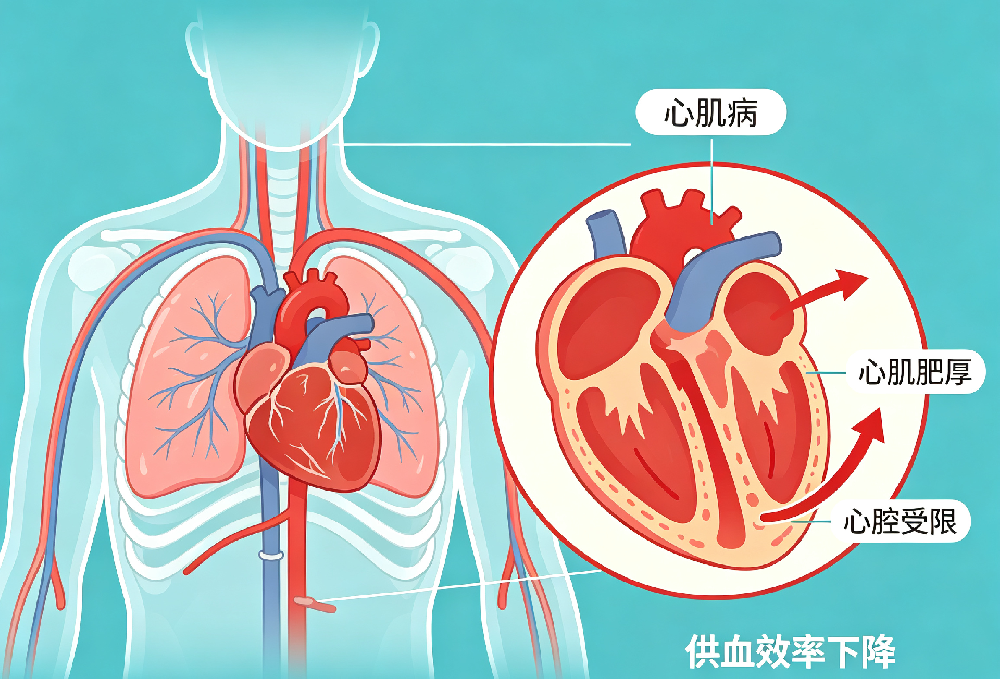 心肌病有什么症状，长期饮酒与心肌病有何关系？