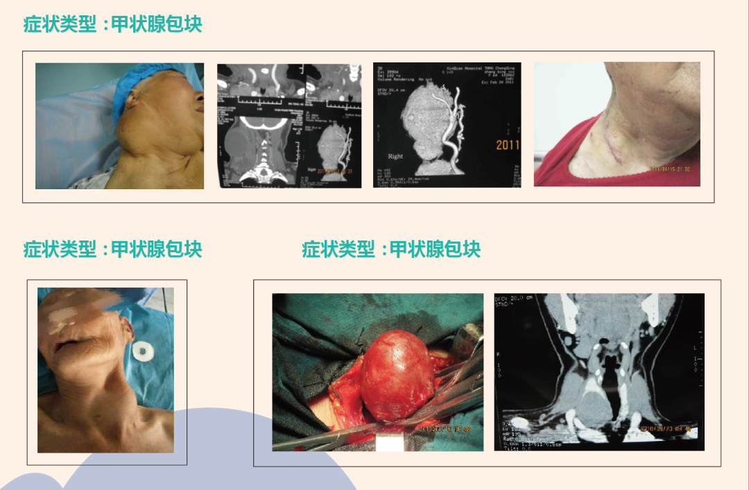 【仁品动态】重庆仁品甲状腺专病中心： 三医大专家领衔 开创多学科联合诊疗新模式